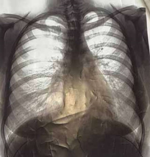 Изображение на обложке